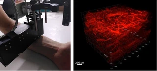 Experimental all-optical photoacoustic system and a reconstructed vascular image from a human forearm.