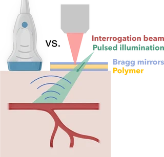 Principle of photoacoustic imaging: pulsed illumination generates ultrasound at optical absorbers, and the recorded waves are used to reconstruct an image.