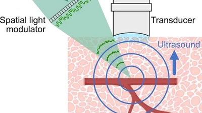 Photoacoustic-guided wavefront shaping featured image