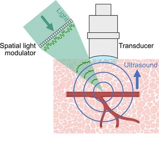 Principle of photoacoustic-guided optical wavefront shaping in scattering tissue.